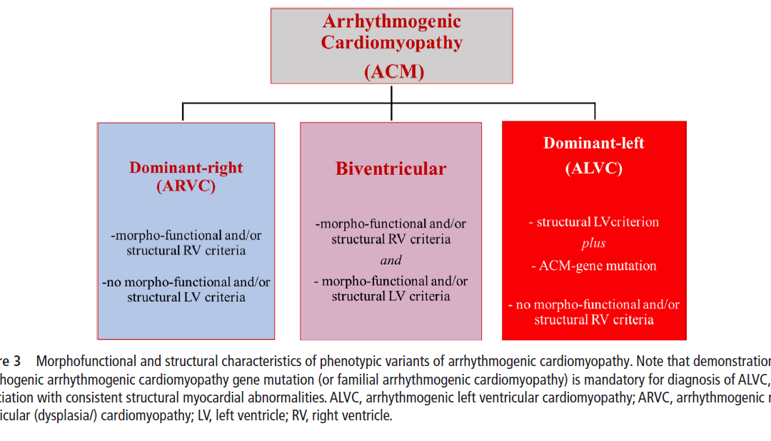 Miocardiopatía arritmogénica