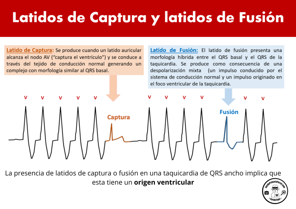 CardioTruco: latidos de captura y fusión - Cardioprimaria Ferrol